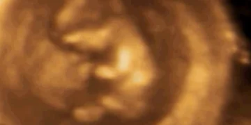 Ультразвуковые исследования при беременности | УЗИ в клинике 